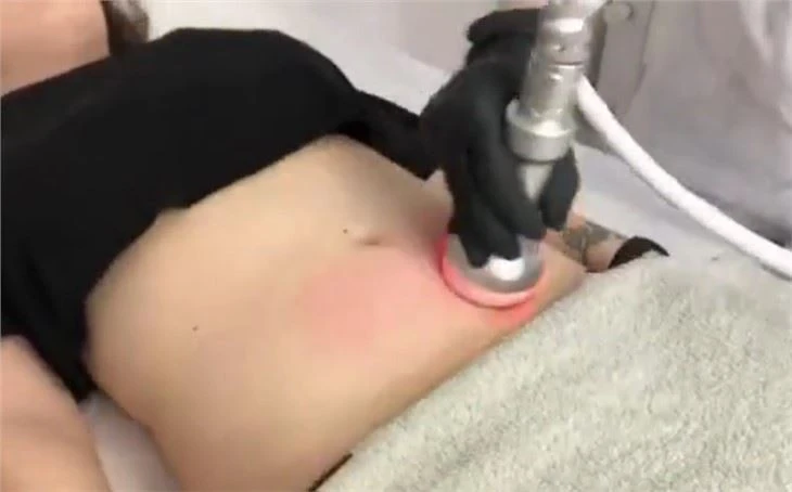 Cryoslimming Machine