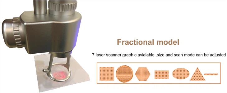 Fotona 4d SP Dynamis Pro