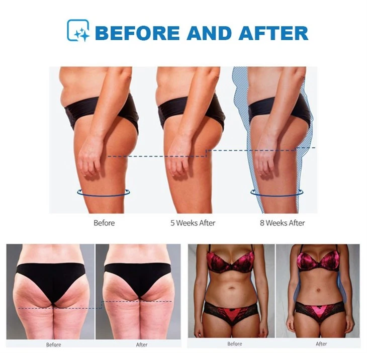 Pelvic Floor Muscle Repair Machine